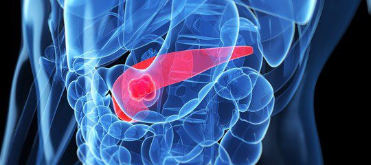 Cancro del pancreas: nuove cure in sperimentazione