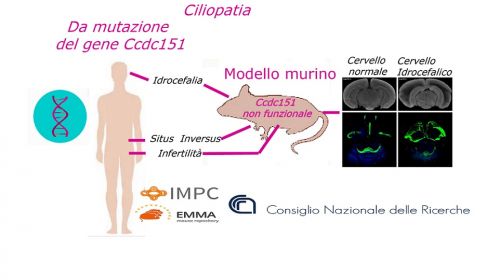 Malattie congenite: nuovi studi sulla ciliopatia