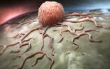 Nuove scoperte sul tumore ovarico