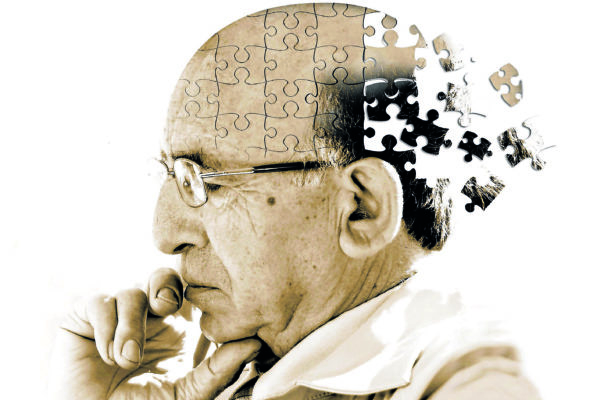 Uno studio longitudinale sull'invecchiamento cerebrale
