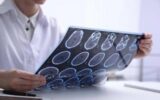 Sin: "Diagnosi più rapide e farmaci innovativi cambiano decorso sclerosi multipla" Sin: "Diagnosi più rapide e farmaci innovativi cambiano decorso sclerosi multipla"