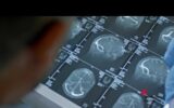 Fenilchetonuria, ‘screening neonatale evita danni neurologici ma serve continuità assistenziale’