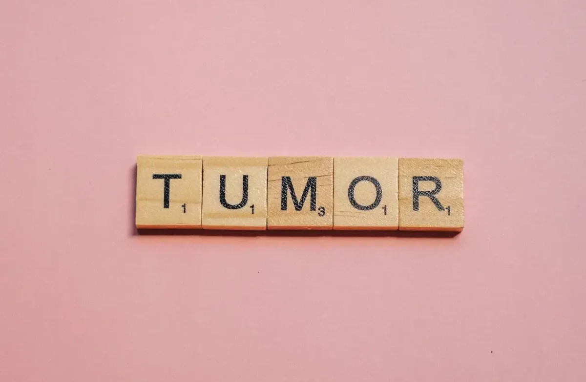 Tumore dell’endometrio avanzato: una nuova terapia?