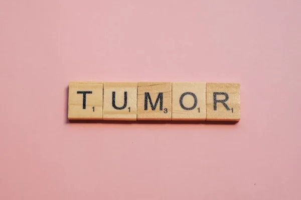 Tumore dell’endometrio avanzato: una nuova terapia? Tumore dell’endometrio avanzato: una nuova terapia?